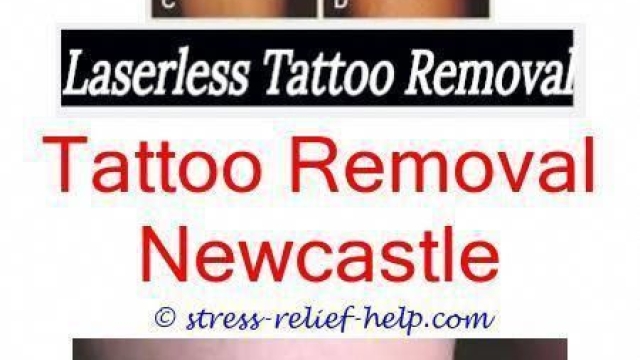 Tattoo Removal Cream – Which Is The Better?