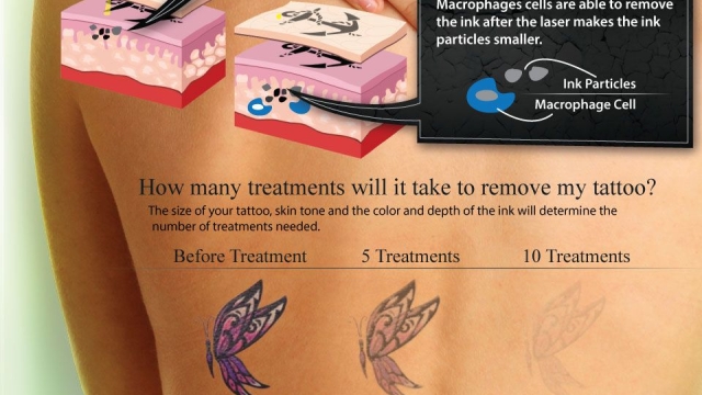 Wrecking Balm Tattoo Removal Cream Guide