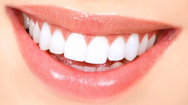 Shining Smiles: Unveiling the Secrets of Teeth Whitening