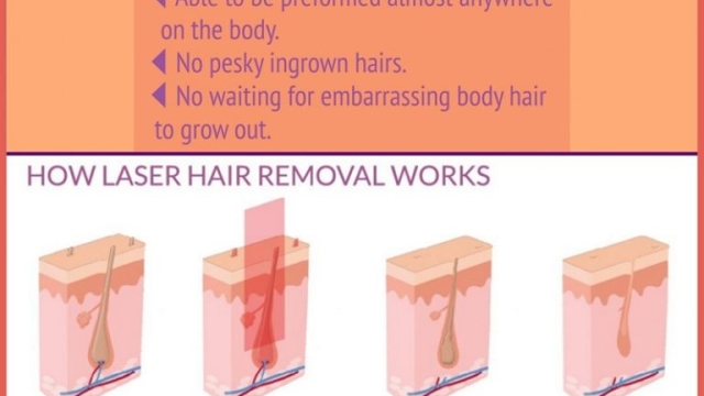 Say Goodbye to Unwanted Hair: Unleashing the Magic of Laser Hair Removal