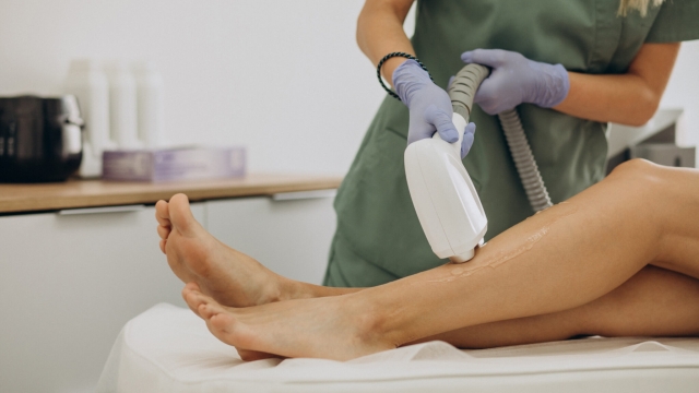 The Ultimate Guide to Laser Hair Removal: Unveiling Smooth, Hair-Free Skin